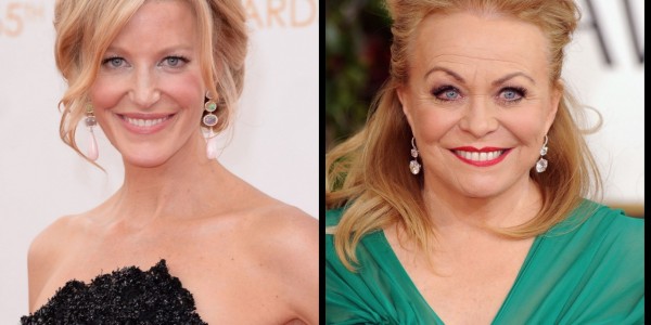 Anna Gunn and Jacki Weaver Cast in Broadchurch Remake